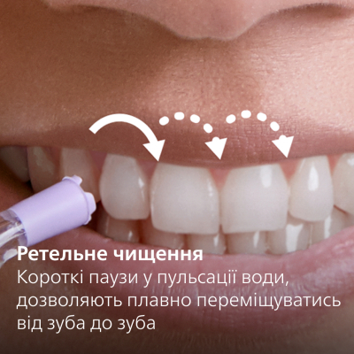 Ирригатор Philips HX3911/40 фото №3